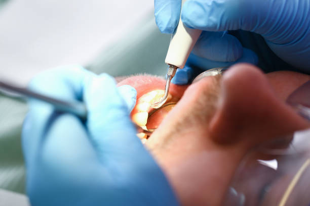 Best Emergency Dental Care for Broken or Chipped Teeth in Yorklyn, PA